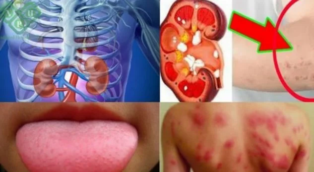 It's being used by everyone! This secret recipe cleanses the body of carcinogenics