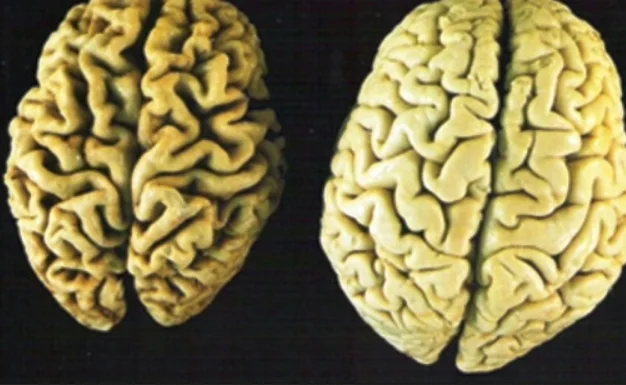 Some Habits That Exert Your Mind