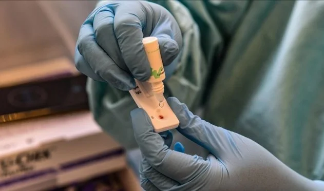 Cas de coronavirus au Monténégro, confirmés par une infection