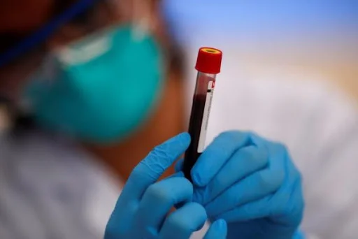 Macedonia: So far, blood plasma has been provided for 23 patients with Ovid 19