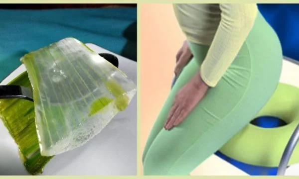 The Hemorrhoids are removed in this way