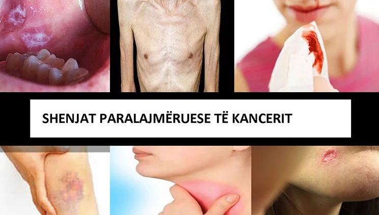 10 Segni di avvertimento del cancro Non dovresti ignorare prima che sia troppo tardi