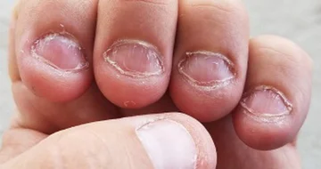 3 Practical advice to stop eating nails once and for all