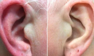 Perché il nostro orecchio diventa rosso e caldo a volte?