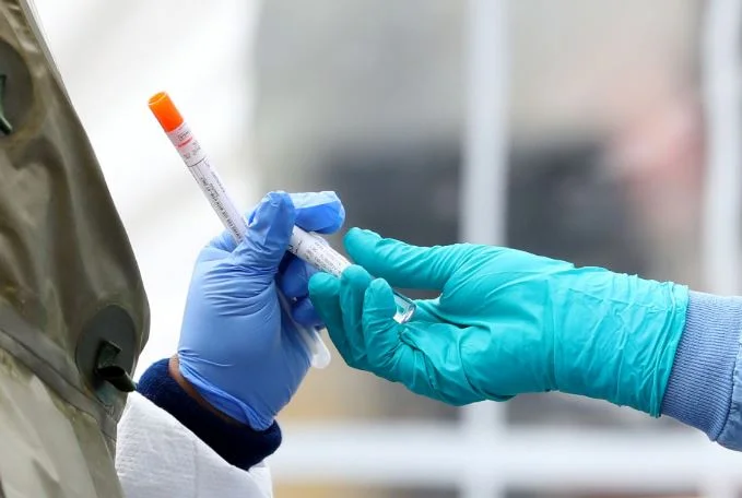 David-19: Allemagne avec 289 nouveaux cas et dix décès