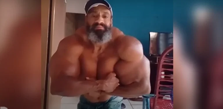 He injected dangerous oils into the body, Brazilian bodybuilder: I'm the strongest man in the world.