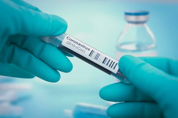 Kosovo-Epidemiologe: Coronavius wird weicher sein, wenn er im Herbst wieder auftaucht