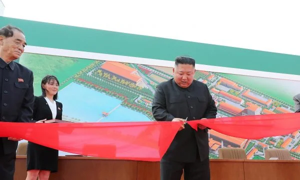 Le immagini che dimostrano Kim Jong Un hanno subito un intervento chirurgico al cuore
