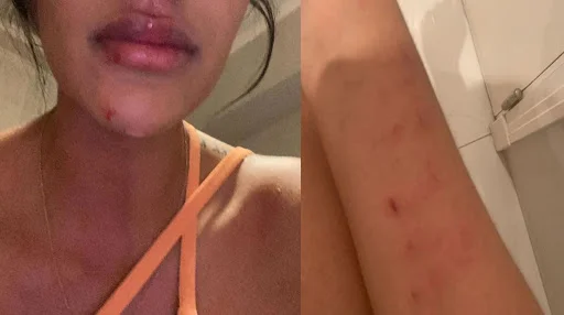 Severe immagini di 23enne calciatore che brutalmente violato la sua ragazza