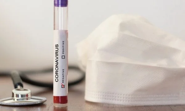 Shkon në 51 numri i të prekurve me koronavirus në Shqipëri