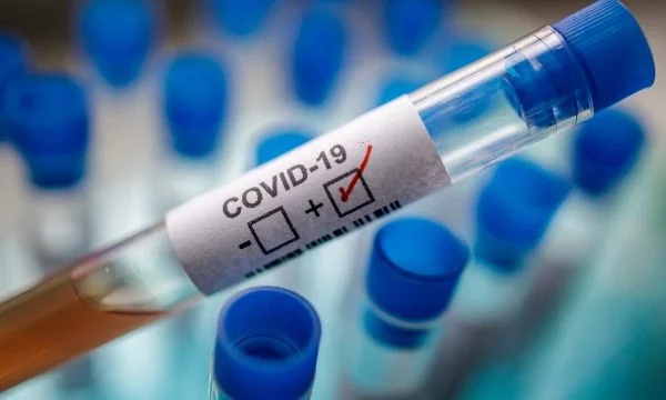 Due casi coronavirus positivi di Rahoveci sono infermiere