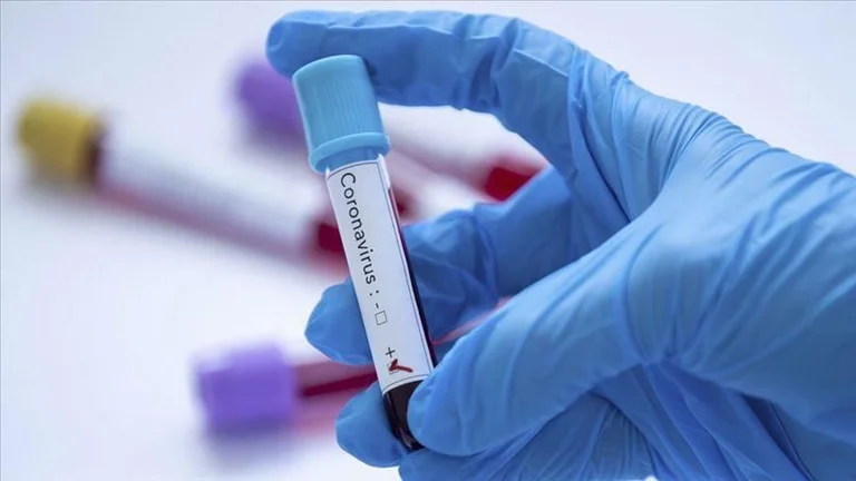 Incluso 41 Coronavirus tocado en el norte de Macedonia