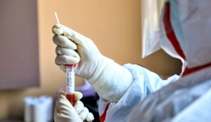 Coronavirus, más curado que infectado en Macedonia