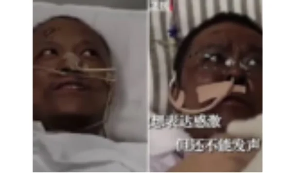 Coronavirus bore the skin of two infected Chinese doctors