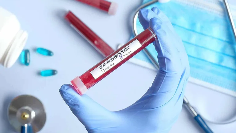 Seven dead of coronavirus in Serbia