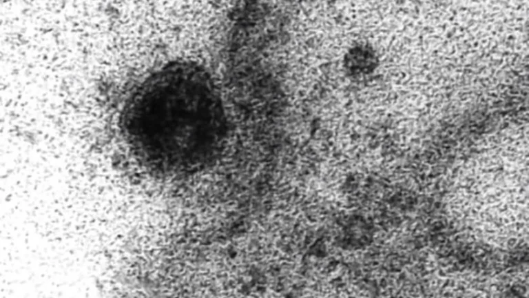 Nel momento in cui la coronaria entra nella cellula umana e la infetta, i ricercatori brasiliani estrae immagini