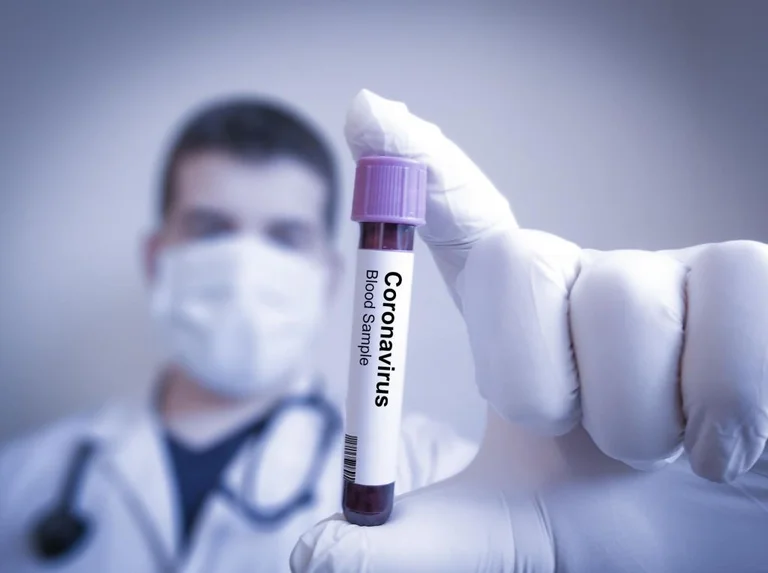 Infectian Ahmeti: Il numero di infetti coronari può essere ancora maggiore