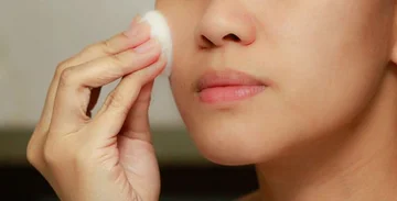 The spring sun leaves stains on your face, such as natural prevention