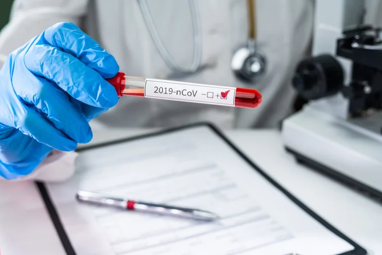 Sei casi Coronavirus confermati in Kukes