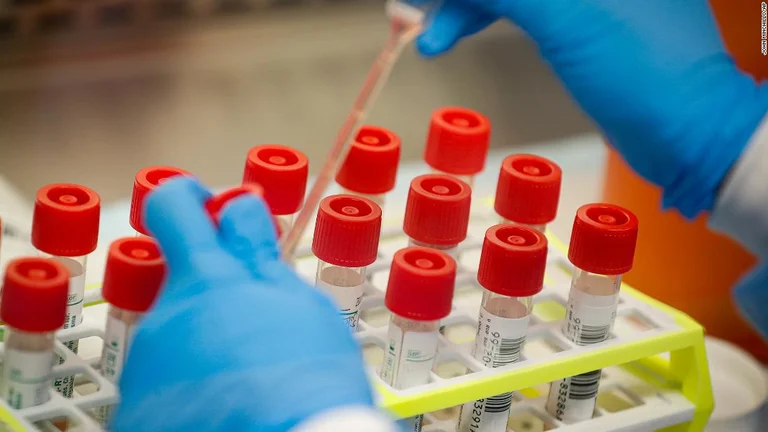 Another case of coronavirus from the Suhareka Community