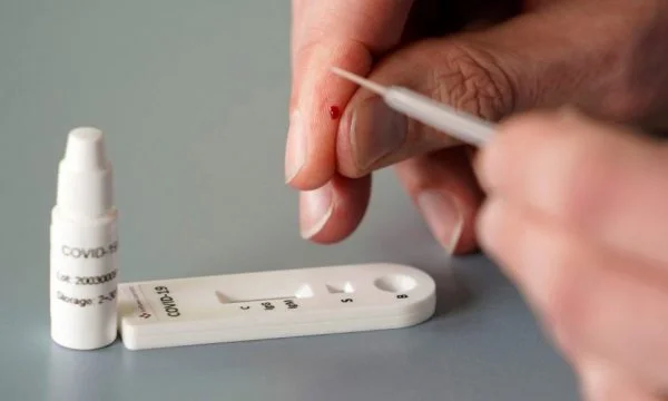 Nearly the quick test that can take the world out of quarantine shows immunity to COVID-19