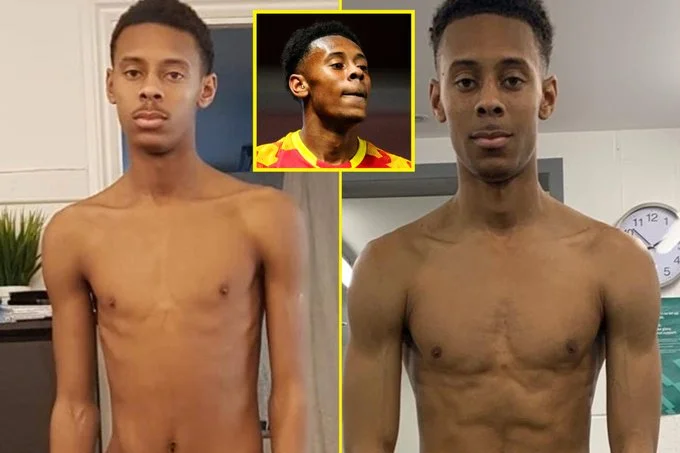La triste histoire du footballeur de Norwich City : La peur du koronobius et la maladie qu'il a mangée du club