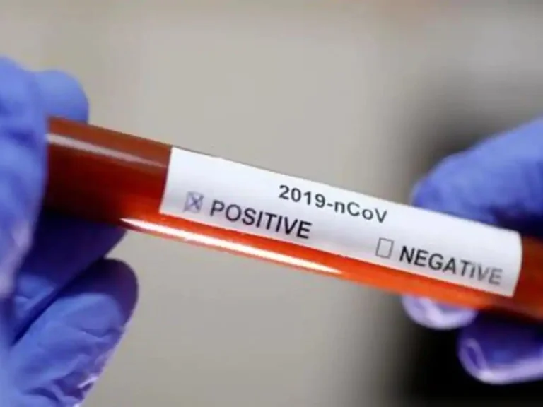 Coronavirus affected by the village of Kline live in Pristina