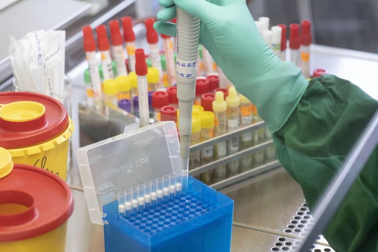 Lutte contre le coronervirus au Kosovo, a proposé de guérir le plasma comme médicament pour les autres