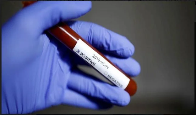 Un total de 1871 personnes testées pour le coronaire, 140 se sont révélées positives