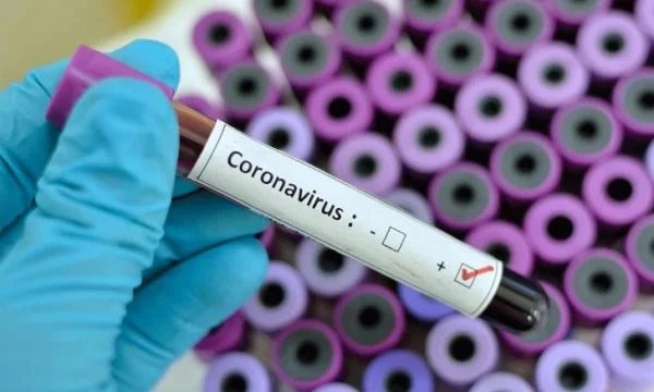 Two nurses and a doctor have been infected with coronarys at the Gjakova Hospital