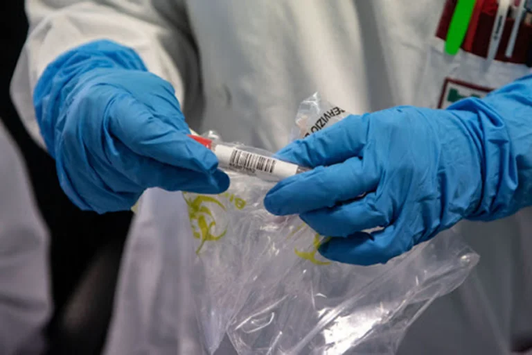 Neun Jahre altes Coronavirus-Opfer in Albanien ist 52 Jahre alt