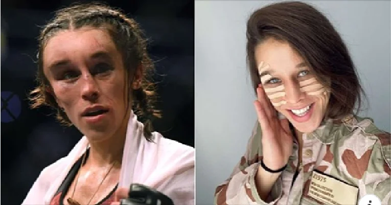 UFC fighter's extraordinary transformation after brutal medicine in cage