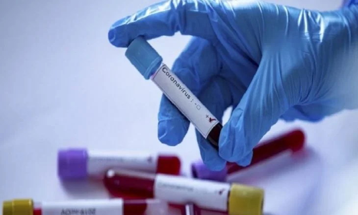 Këto janë rezultatet e analizave për koronavirus të mjekëve nga Vitia
