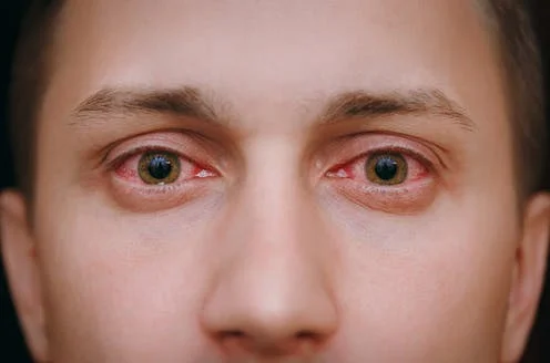 Check: Augen offenbaren, wenn du koronar hast