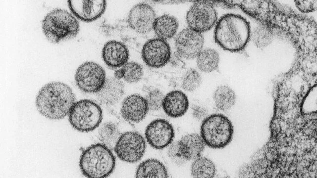 According to Chinese state meds, the Coronavirus first existed in Italy