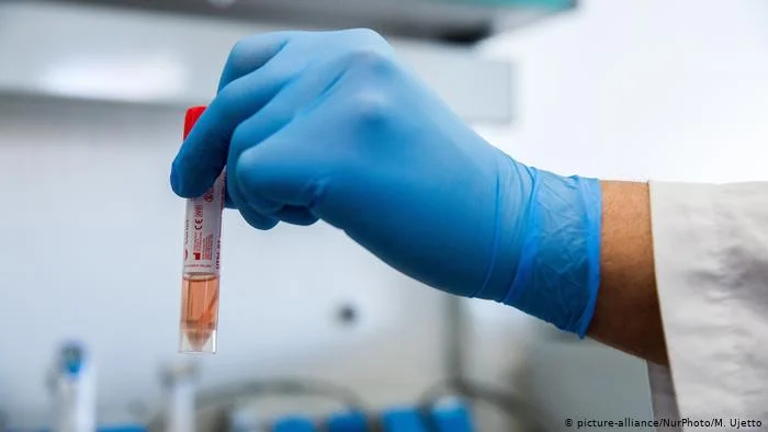 Épidémiologiste italien: Les effets du coronervirus diffèrent des groupes ethniques