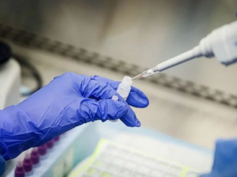 24 Stunden lang sieben Opfer von Coronavirus im Kosovo und der Region