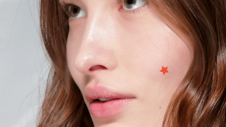 Comment se débarrasser d'un bouton dans une heure et le rendre moins rouge