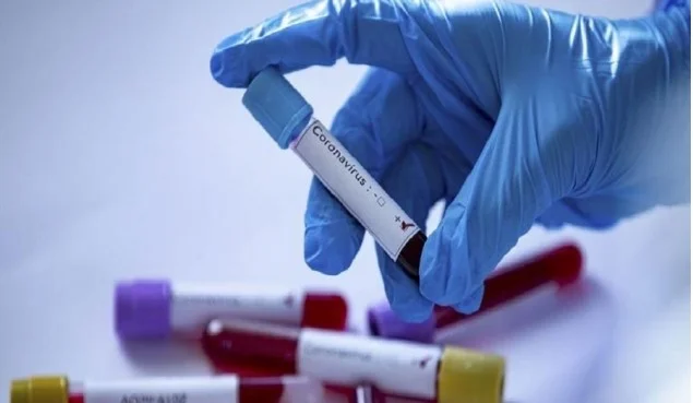 Mbi 200 mijë të infektuar me koronavirus në botë