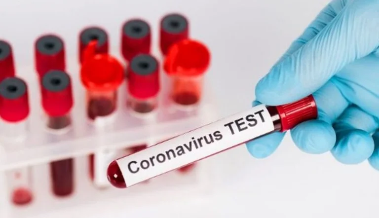 Çifti i prekur me koronavirus ka qëndruar për disa ditë në Gjakovë