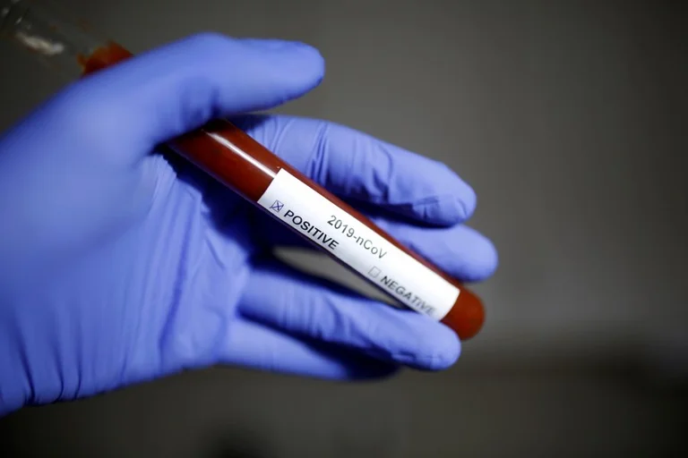 Dyshimet për koronavirus, 48 persona kanë shkuar për analiza sot në QKUK