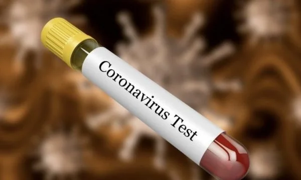 207 coronary samples at KKUK have been tested
