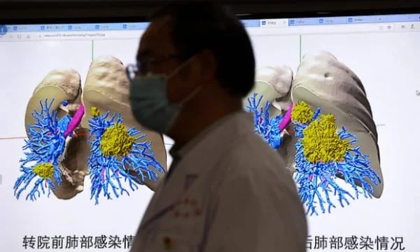 What happens to human lungs when they are infected with coronarys