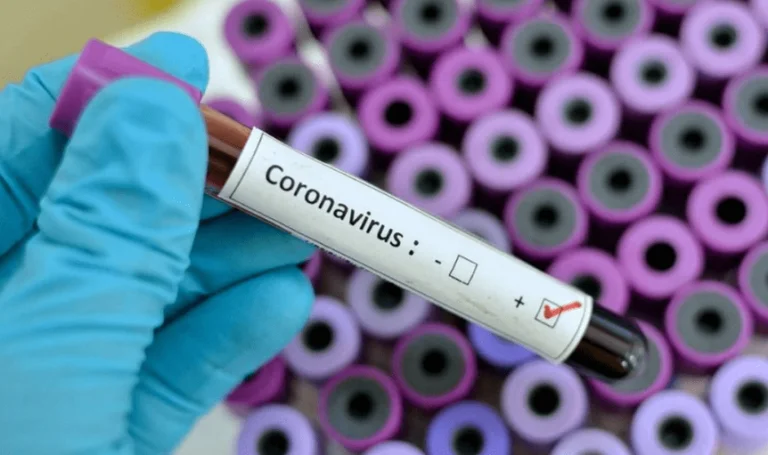 Another Coronavirus case in Serbia, the number of affected reaches 19