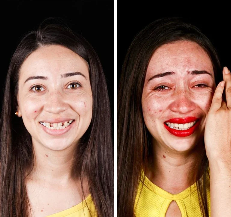 Il dentista viaggia in tutto il mondo per far sorridere le persone e il risultato è fantastico