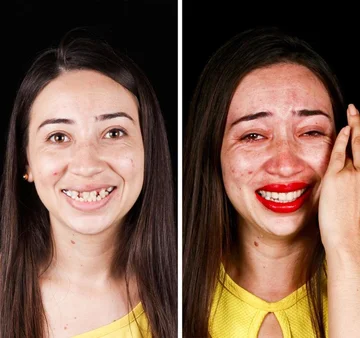 The dentist travels around the world to make people smile and the result is fantastic