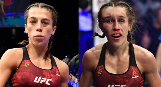 UFC golpe brutal, dos guerreros lucharon duro.
