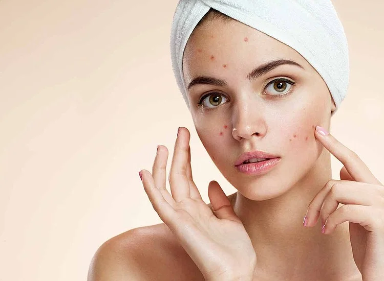 Skin needs these four vitamins to look beautiful