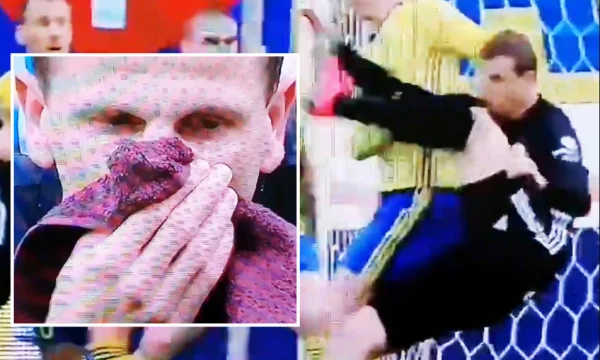 Il difensore si è rotto il naso cercando di segnare gol aerobatici