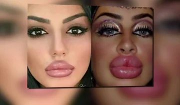 Le operazioni estetiche creano tre tipi di malattie pericolose